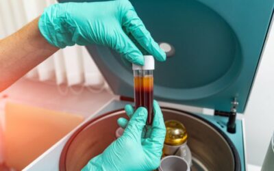 Plasma rico en plaquetas (PRP): la terapia natural para tu piel y cabello