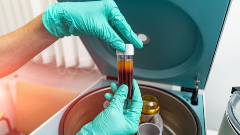 Plasma rico en plaquetas (PRP): la terapia natural para tu piel y cabello