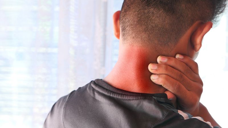 brotes inflamatorios
