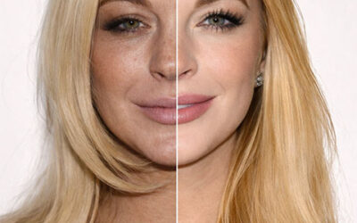 rejuvenecimiento-lindsay-lohan