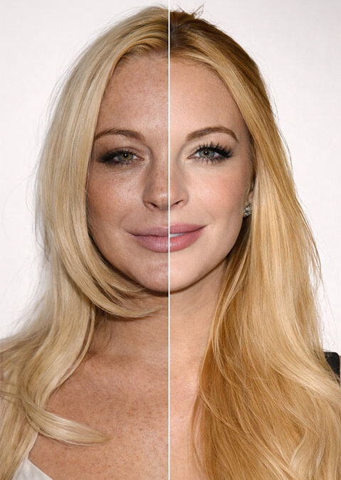 rejuvenecimiento-lindsay-lohan